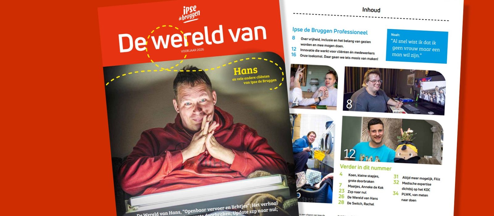 Hans met zijn uv-lamp